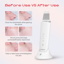 Ultrazvukový peeling MAXGROOM M-169 s LED terapií - bílý